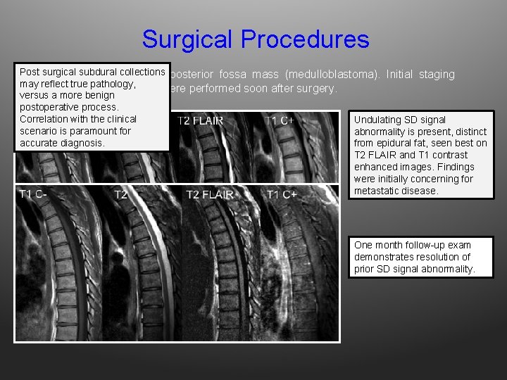 Surgical Procedures Post collections 32 surgical yo M subdural s/p resection of posterior fossa