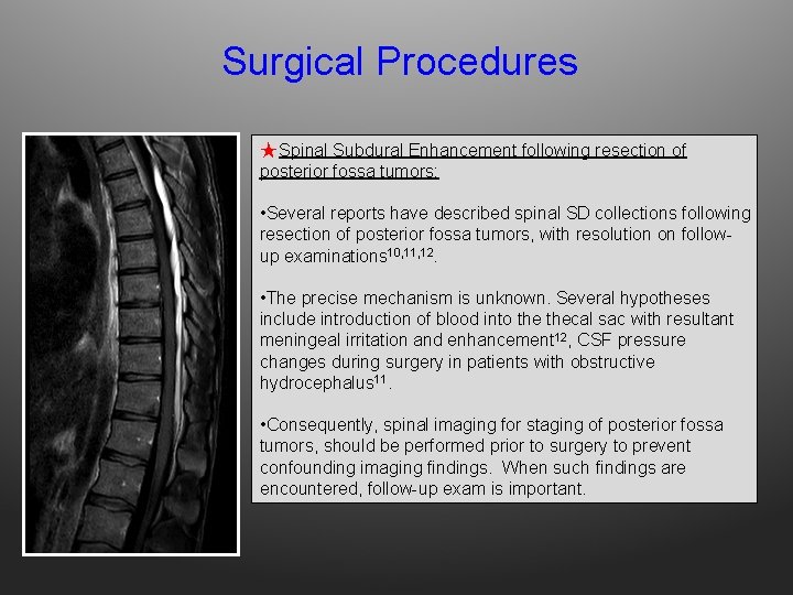 Surgical Procedures ★ Spinal Subdural Enhancement following resection of posterior fossa tumors: • Several