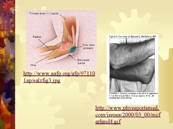 http: //www. aafp. org/afp/97110 1 ap/salzfig 3. jpg http: //www. physsportsmed. com/issues/2000/03_00/mcf arland 4.
