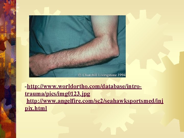 -http: //www. worldortho. com/database/introtrauma/pics/img 0123. jpg http: //www. angelfire. com/sc 2/seahawksportsmed/inj pix. html 