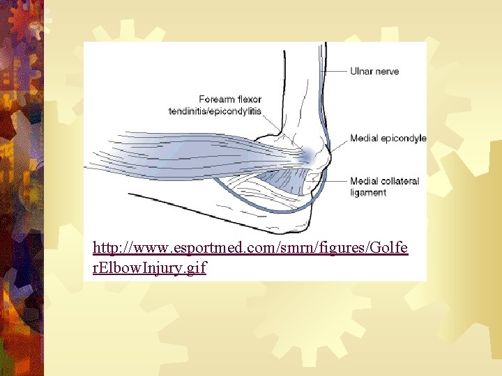 http: //www. esportmed. com/smrn/figures/Golfe r. Elbow. Injury. gif 