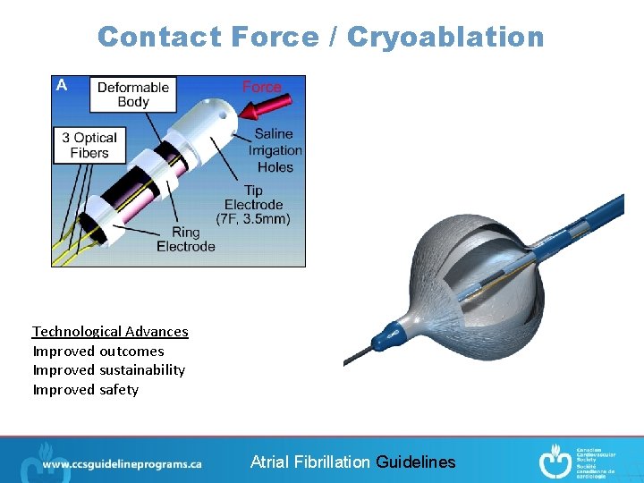 Contact Force / Cryoablation Technological Advances Improved outcomes Improved sustainability Improved safety Atrial Fibrillation