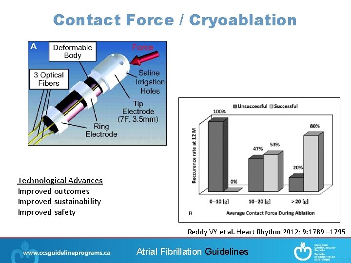 Contact Force / Cryoablation Technological Advances Improved outcomes Improved sustainability Improved safety Reddy VY