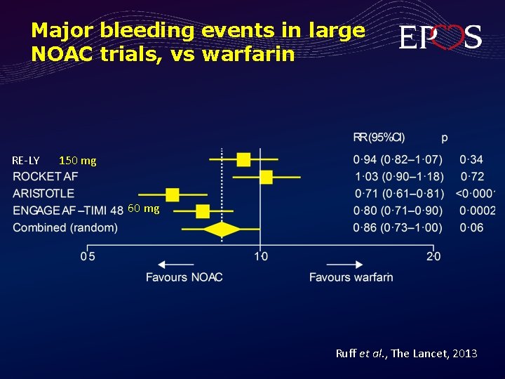 Major bleeding events in large NOAC trials, vs warfarin RE-LY 150 mg 60 mg