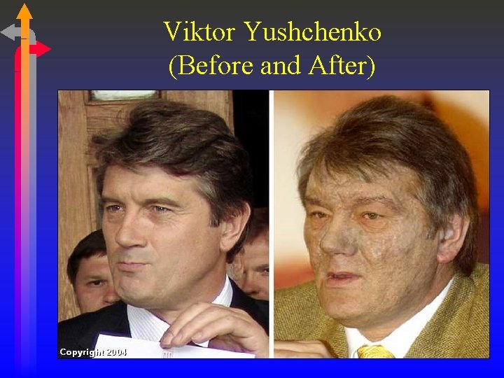 Viktor Yushchenko (Before and After) 