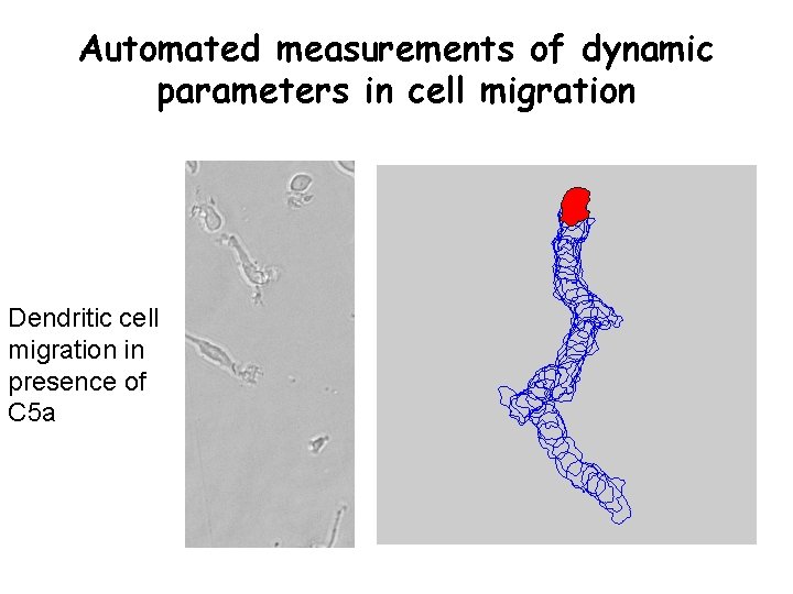 Automated measurements of dynamic parameters in cell migration Dendritic cell migration in presence of