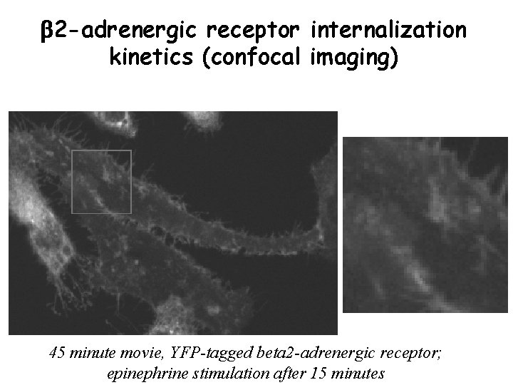 b 2 -adrenergic receptor internalization kinetics (confocal imaging) 45 minute movie, YFP-tagged beta 2