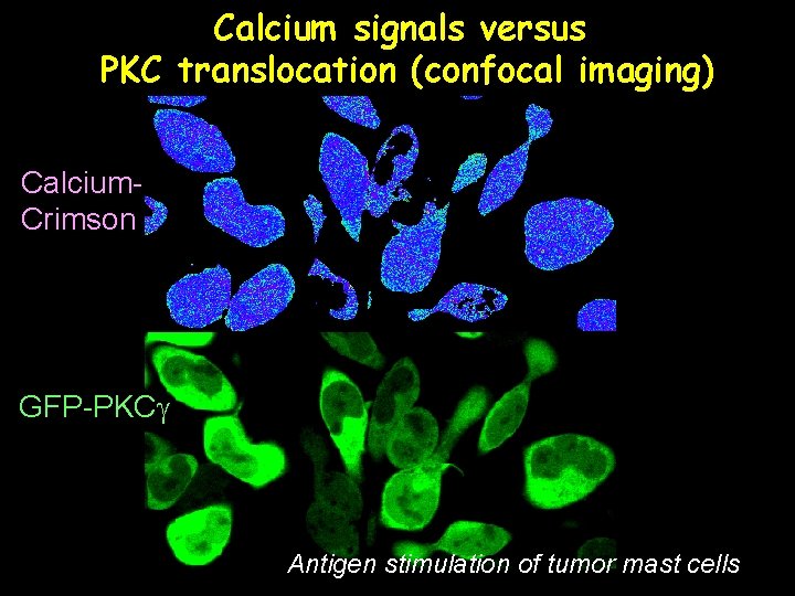 Calcium signals versus PKC translocation (confocal imaging) Calcium. Crimson GFP-PKCg Antigen stimulation of tumor