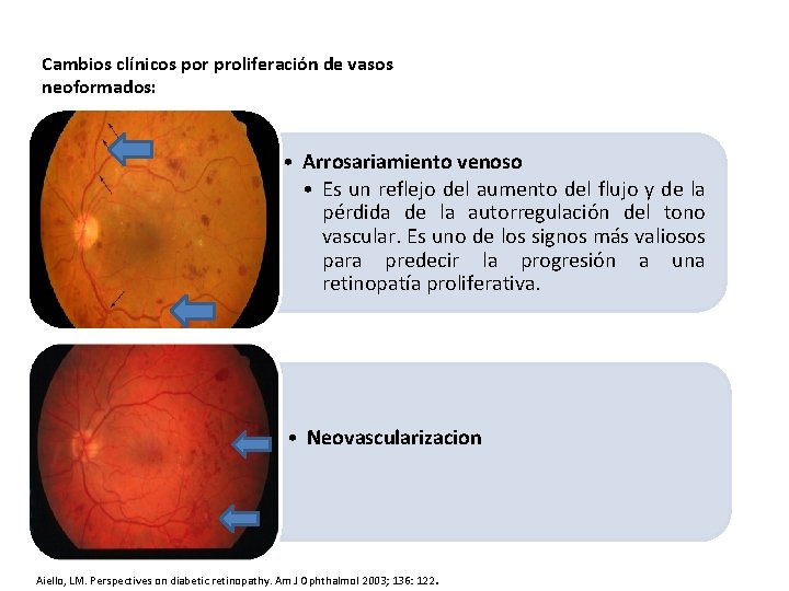 Cambios clínicos por proliferación de vasos neoformados: • Arrosariamiento venoso • Es un reflejo