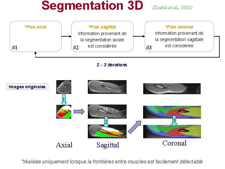 Segmentation 3 D *Plan axial *Plan sagittal information provenant de la segmentation axiale est