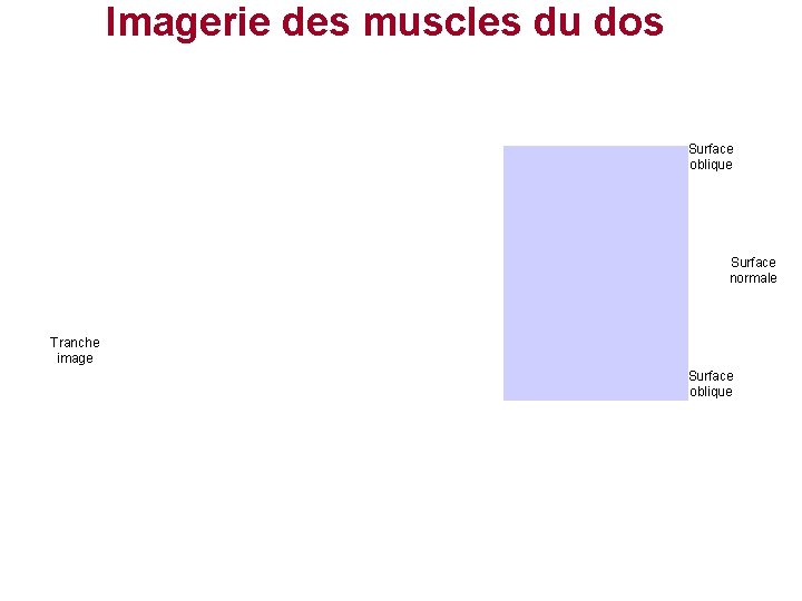 Imagerie des muscles du dos Surface oblique Surface normale Tranche image Surface oblique 