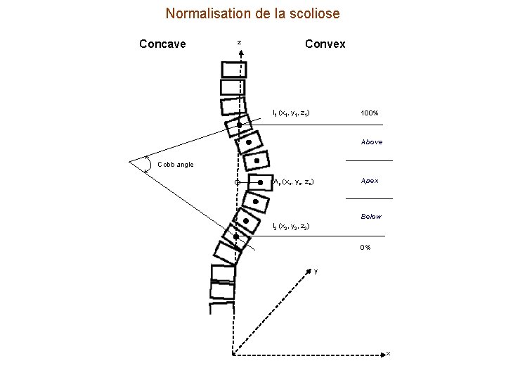 Normalisation de la scoliose Concave z Convex I 1 (x 1, y 1, z