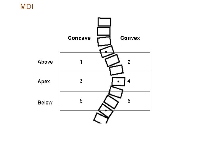 MDI Concave Convex Above 1 2 Apex 3 4 Below 5 6 