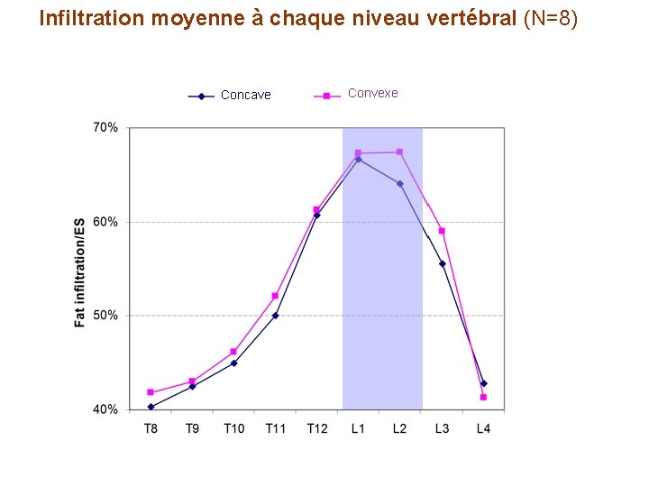 Infiltration moyenne à chaque niveau vertébral (N=8) Concave Convexe 