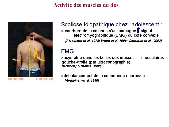 Activité des muscles du dos Scoliose idiopathique chez l’adolescent : Ø courbure de la