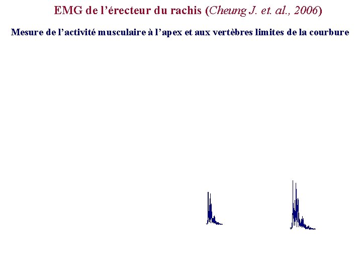 EMG de l’érecteur du rachis (Cheung J. et. al. , 2006) Mesure de l’activité