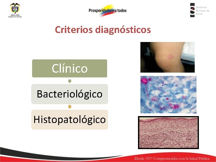 Criterios diagnósticos Clínico Bacteriológico Histopatológico 