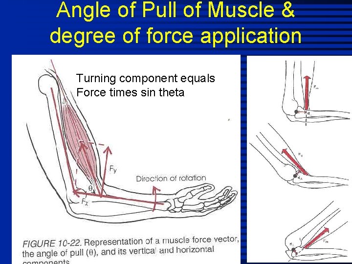 Angle of Pull of Muscle & degree of force application Turning component equals Force
