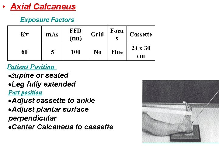  • Axial Calcaneus Exposure Factors Kv m. As FFD (cm) 60 5 100
