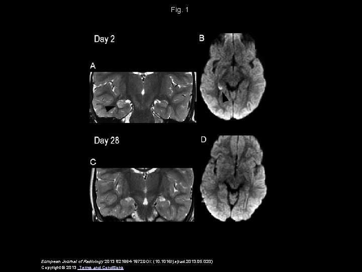 Fig. 1 European Journal of Radiology 2013 821964 -1972 DOI: (10. 1016/j. ejrad. 2013.