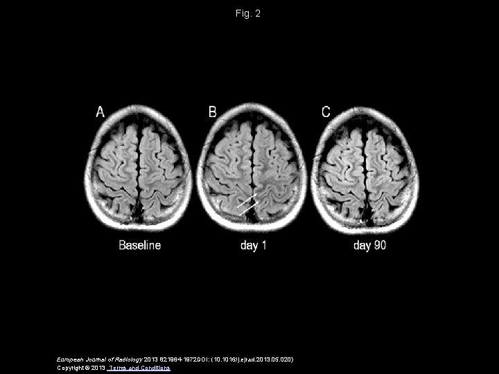 Fig. 2 European Journal of Radiology 2013 821964 -1972 DOI: (10. 1016/j. ejrad. 2013.