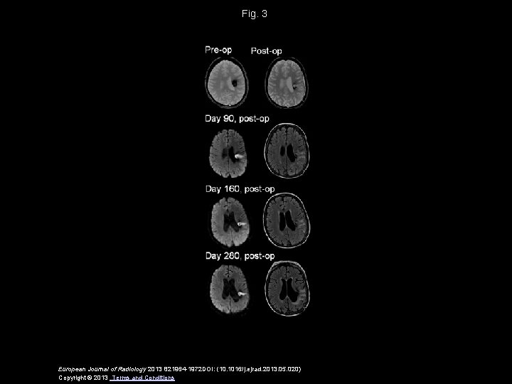 Fig. 3 European Journal of Radiology 2013 821964 -1972 DOI: (10. 1016/j. ejrad. 2013.