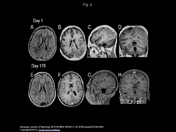 Fig. 4 European Journal of Radiology 2013 821964 -1972 DOI: (10. 1016/j. ejrad. 2013.