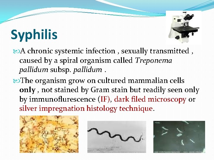 Syphilis A chronic systemic infection , sexually transmitted , caused by a spiral organism