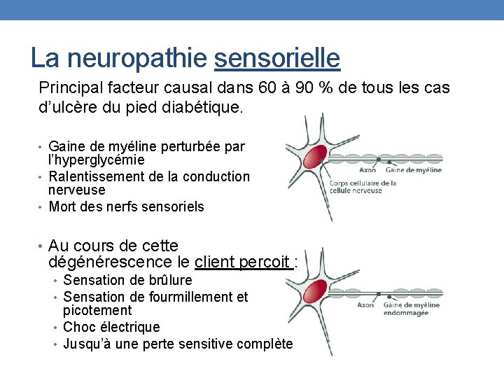 La neuropathie sensorielle Principal facteur causal dans 60 à 90 % de tous les