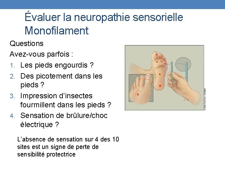 Évaluer la neuropathie sensorielle Monofilament Questions Avez-vous parfois : 1. Les pieds engourdis ?