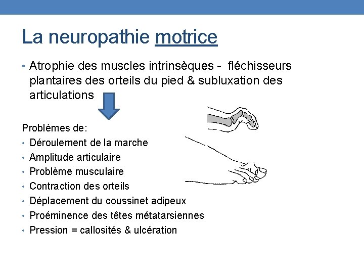 La neuropathie motrice • Atrophie des muscles intrinsèques - fléchisseurs plantaires des orteils du