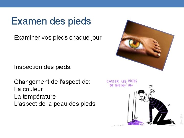 Examen des pieds Examiner vos pieds chaque jour Inspection des pieds: Changement de l’aspect