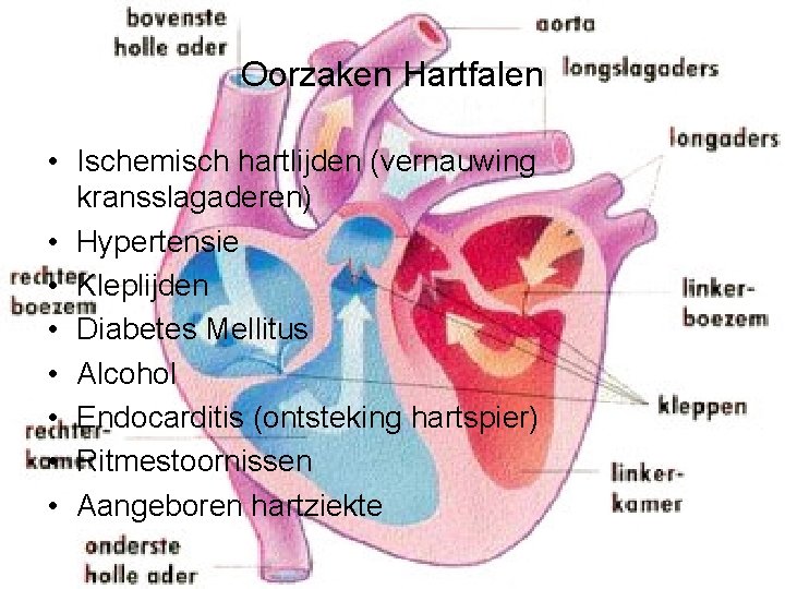 Oorzaken Hartfalen • Ischemisch hartlijden (vernauwing kransslagaderen) • Hypertensie • Kleplijden • Diabetes Mellitus