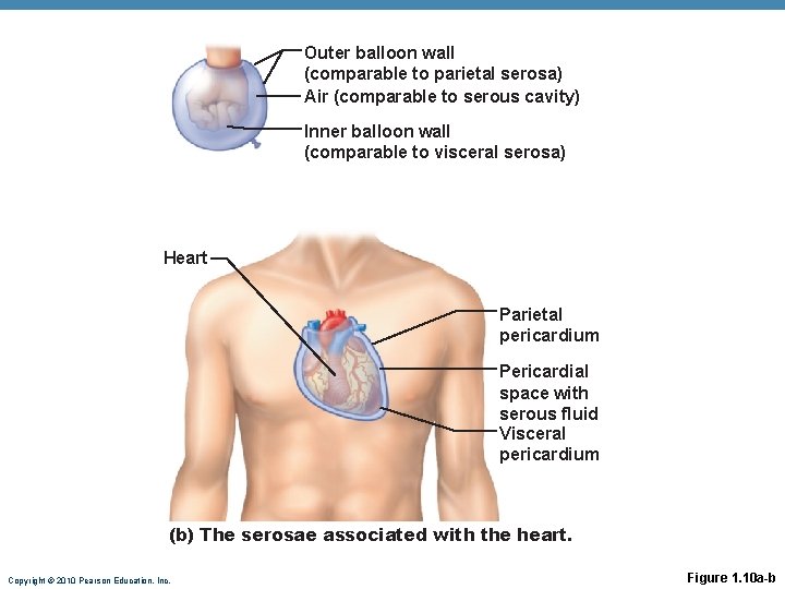 Outer balloon wall (comparable to parietal serosa) Air (comparable to serous cavity) Inner balloon