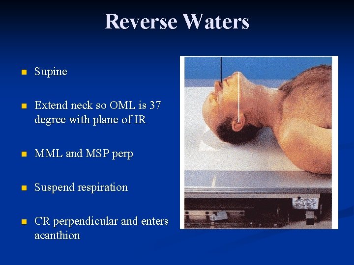 Reverse Waters n Supine n Extend neck so OML is 37 degree with plane