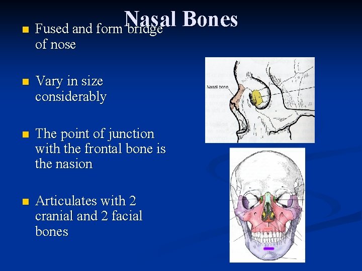 n Nasal Bones Fused and form Nasal bridge of nose n Vary in size