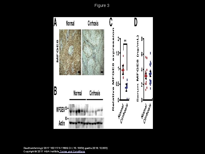 Figure 3 Gastroenterology 2017 1521174 -1186 DOI: (10. 1053/j. gastro. 2016. 12. 003) Copyright