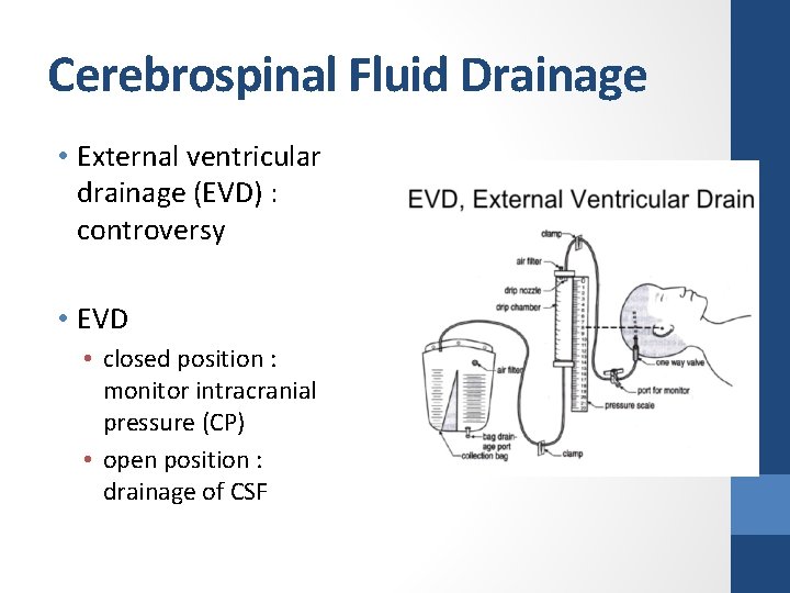 Cerebrospinal Fluid Drainage • External ventricular drainage (EVD) : controversy • EVD • closed