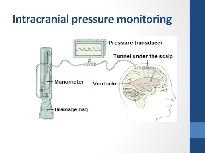 Intracranial pressure monitoring 