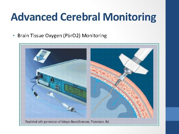 Advanced Cerebral Monitoring • Brain Tissue Oxygen (Pbr. O 2) Monitoring 