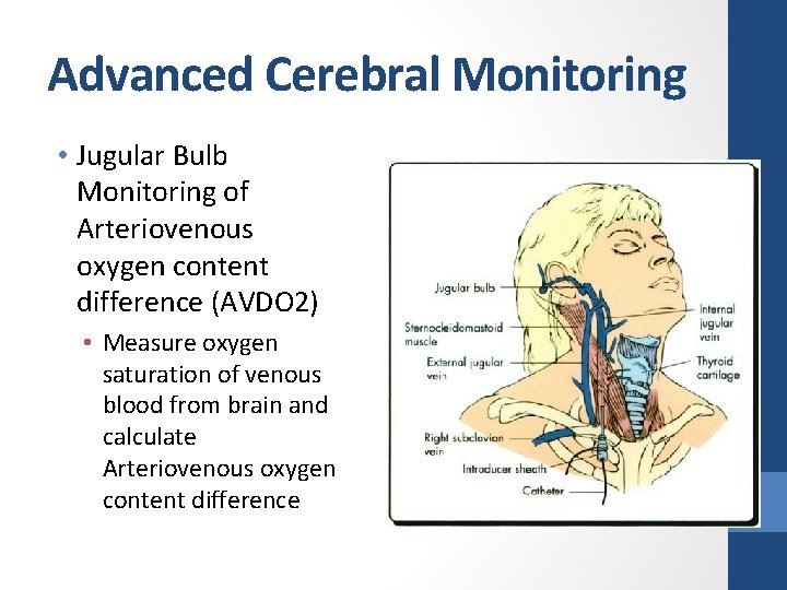 Advanced Cerebral Monitoring • Jugular Bulb Monitoring of Arteriovenous oxygen content difference (AVDO 2)
