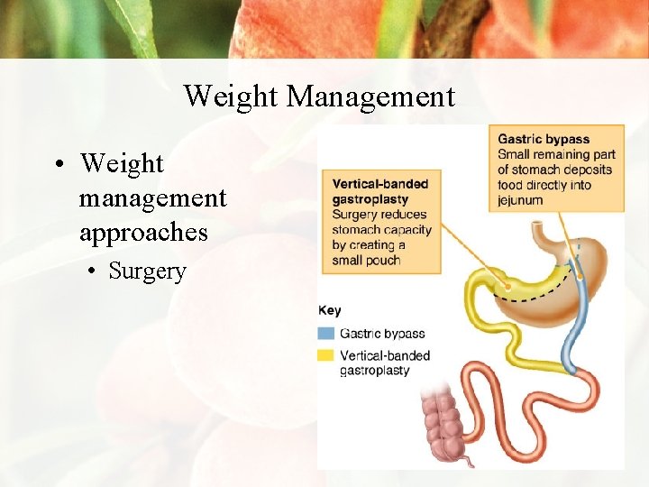 Weight Management • Weight management approaches • Surgery 
