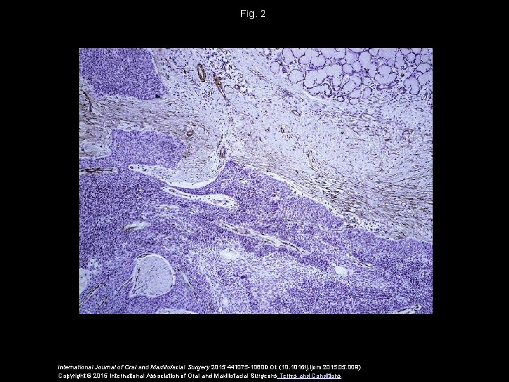 Fig. 2 International Journal of Oral and Maxillofacial Surgery 2015 441075 -1080 DOI: (10.