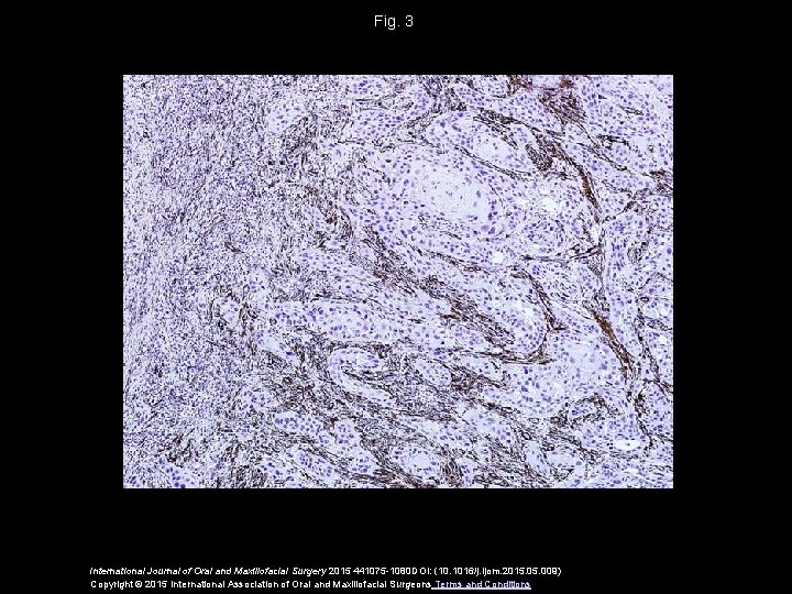 Fig. 3 International Journal of Oral and Maxillofacial Surgery 2015 441075 -1080 DOI: (10.