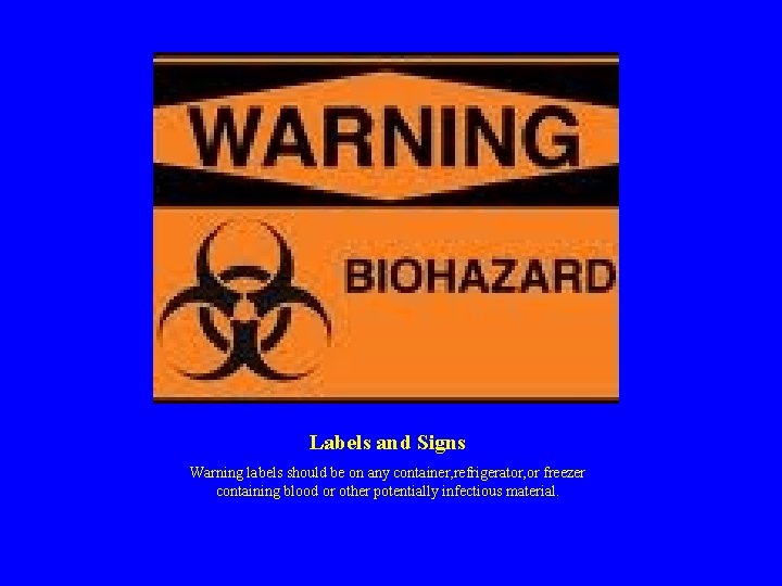 Labels and Signs Warning labels should be on any container, refrigerator, or freezer containing