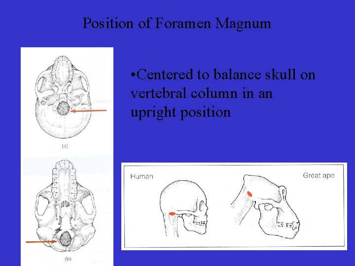 Position of Foramen Magnum • Centered to balance skull on vertebral column in an
