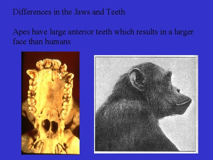 Differences in the Jaws and Teeth Apes have large anterior teeth which results in