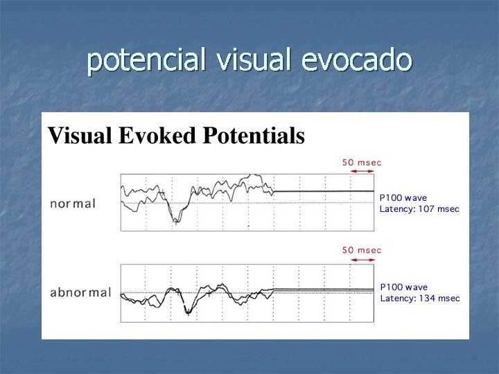 potencial visual evocado 