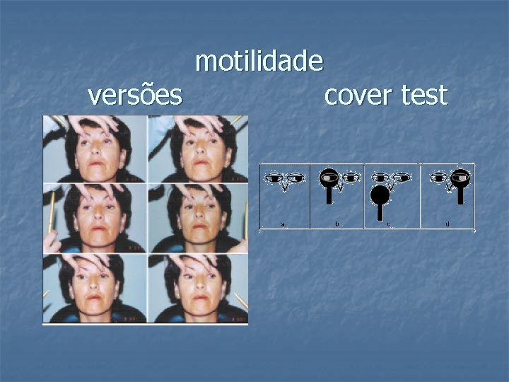 versões motilidade cover test 