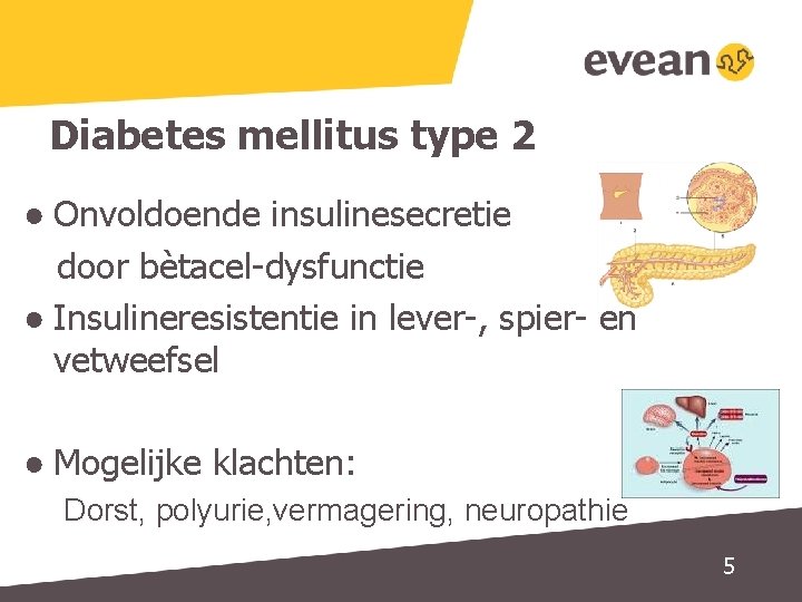 Diabetes mellitus type 2 ● Onvoldoende insulinesecretie door bètacel-dysfunctie ● Insulineresistentie in lever-, spier-